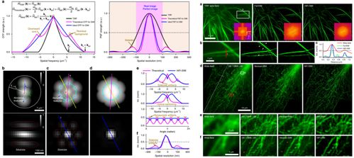 蘇州醫(yī)工所結(jié)構(gòu)光照明超分辨顯微成像技術(shù)研究取得系列進展